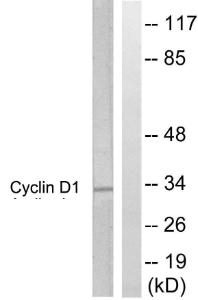 Western blot analysis of lysates from Jurkat cells, treated with EGF 200ng/ml 30' using Anti-Cyclin D1 Antibody. The right hand lane represents a negative control, where the antibody is blocked by the immunising peptide.