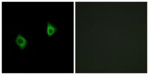 Immunofluorescence analysis of A549 cells using Anti-RPS9 Antibody. The right hand panel represents a negative control, where the antibody was pre-incubated with the immunising peptide.