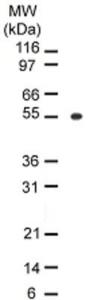 Anti-BTF3P11 Mouse Monoclonal Antibody [clone: 98A1071]