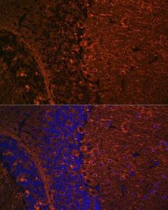 Immunofluorescence analysis of mouse brain using Anti-beta III Tubulin Antibody [ARC0456] (A309019) at a dilution of 1:100 (40x lens) DAPI was used to stain the cell nuclei (blue)