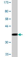 Anti-CCNT2 Mouse Monoclonal Antibody [clone: 1H3]