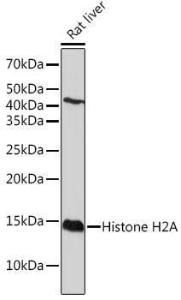 Western blot analysis of extracts of Rat liver, using Anti-Histone H2A Antibody [ARC2072] (A307778) at 1:1,000 dilution The secondary antibody was Goat Anti-Rabbit IgG H&L Antibody (HRP) at 1:10,000 dilution Lysates/proteins were present at 25 µg per lane