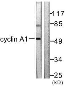 Antibody anti-cyclin A1 100 µg