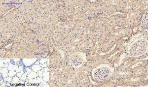 Immunohistochemical analysis of paraffin-embedded rat lung tissue using Anti-IL1B Antibody at 1:200 (4°C overnight). Negative control was secondary antibody only.