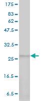 Anti-PSMA7 Mouse Monoclonal Antibody [clone: 1A10-3G12]