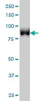 Anti-TLK1 Mouse Monoclonal Antibody [clone: 4B3]