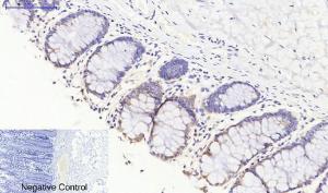 Immunohistochemical analysis of paraffin-embedded human colon tissue using Anti-JAK3 Antibody at 1:200 (4°C overnight) Negative control was secondary antibody only