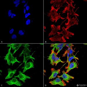 Immunocytochemistry/Immunofluorescence analysis of human neuroblastoma cell line (SK-N-BE, fixed in 4% formaldehyde for 15 min at room temperature, using Anti-NMDAR1 Antibody [S308-48] (A304953), at 1:100 for 60 minutes at room temperature