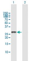 Anti-DUT Rabbit Polyclonal Antibody