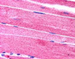 Anti-SORBS1 Antibody (A83040) (2.5µg/ml) staining of paraffin embedded human skeletal muscle. Steamed antigen retrieval with citrate buffer pH 6, AP-staining.