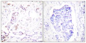 Antibody anti-cyclin A1 100 µg