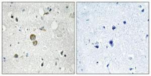 Immunohistochemical analysis of paraffin-embedded human brain using Anti-RPS9 Antibody 1:100 (4°C overnight). The right hand panel represents a negative control, where the antibody was pre-incubated with the immunising peptide.