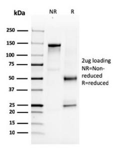 SDS-PAGE analysis of Anti-NKX31 Antibody [NKX31/3347] under non-reduced and reduced conditions; showing intact IgG and intact heavy and light chains, respectively SDS-PAGE analysis confirms the integrity and purity of the antibody