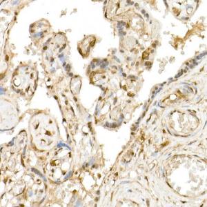 Immunohistochemistry analysis of paraffin-embedded human placenta using Anti-TAZ Antibody (A306094) at a dilution of 1:50 (40x lens). Perform high pressure antigen retrieval with 10 mM citrate buffer pH 6.0 before commencing with IHC staining protocol.