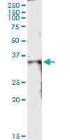 Anti-DUT Rabbit Polyclonal Antibody