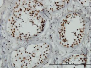 Anti-TLK1 Mouse Monoclonal Antibody [clone: 4B3]