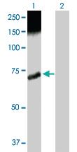 Anti-CAMK2B Rabbit Polyclonal Antibody