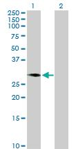 Anti-C1GALT1C1 Mouse Polyclonal Antibody