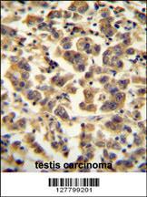 Anti-TTC39B Rabbit Polyclonal Antibody