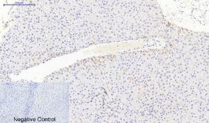 Immunohistochemical analysis of paraffin-embedded human liver tissue using Anti-JAK3 Antibody at 1:200 (4°C overnight) Negative control was secondary antibody only