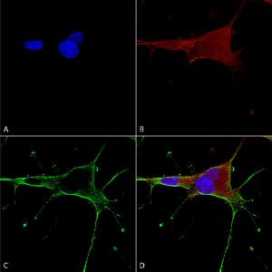 Immunocytochemistry/Immunofluorescence analysis of human neuroblastoma cells (SH-SY5Y), fixed in 4% PFA for 15 min, using Anti-NMDAR1 Antibody [S308-48] (A304953), at 1:50 for overnight at 4°C with slow rocking