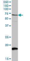 Anti-CAMK2B Rabbit Polyclonal Antibody