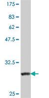 Anti-ADRA1A Mouse Polyclonal Antibody