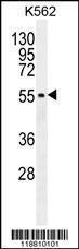 Anti-MITF Rabbit Polyclonal Antibody (AP (Alkaline Phosphatase))