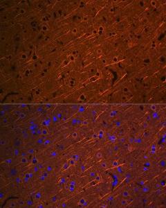 Immunofluorescence analysis of rat brain using Anti-beta III Tubulin Antibody [ARC0456] (A309019) at a dilution of 1:100 (40x lens) DAPI was used to stain the cell nuclei (blue)