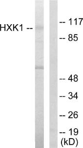 Western blot analysis of lysates from HeLa cells using Anti-HXK1 Antibody. The right hand lane represents a negative control, where the Antibody is blocked by the immunising peptide