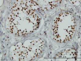 Anti-TLK1 Mouse Monoclonal Antibody [clone: 4B3]