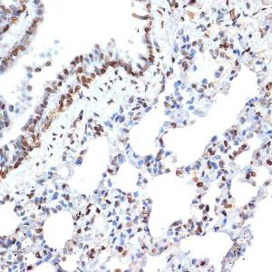 Immunohistochemistry analysis of paraffin-embedded rat lung using Anti-Histone H2A Antibody [ARC2072] (A307778) at a dilution of 1:100 (40x lens) Perform microwave antigen retrieval with 10 mM Tris/EDTA buffer pH 90 before commencing with IHC staining protocol