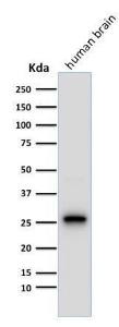 Western blot analysis of human brain tissue lysate using Anti-PGP9.5 Antibody [13C4]