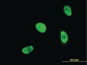 Anti-HOXA5 Mouse Monoclonal Antibody [clone: 4A8]