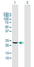 Anti-PGLYRP1 Mouse Polyclonal Antibody