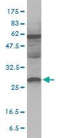 Anti-MREG Mouse Monoclonal Antibody [clone: 8F9-1B2]