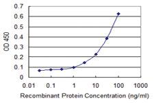 Anti-FBXL21 Mouse Monoclonal Antibody [clone: 4A1]