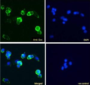 Anti-Dcx Antibody (A83041) Immunofluorescence analysis of paraformaldehyde fixed HepG2 cells