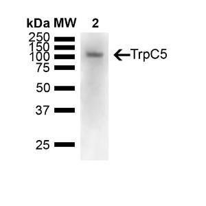 Western blot analysis of mouse brain showing detection of 110 kDa TrpC5 protein using Anti-TRPC5 Antibody [N67/15] (A304954) at 1:1000 for Overnight at 4°C