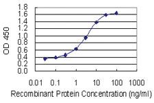 Anti-TLK1 Mouse Monoclonal Antibody [clone: 4B3]