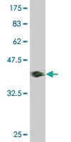 Anti-HNF1B Mouse Monoclonal Antibody [clone: 4E9]