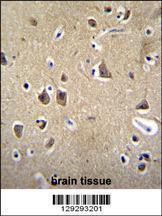 Anti-FADS6 Rabbit Polyclonal Antibody (PE (Phycoerythrin))