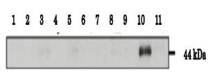 Anti-Calrecticulin 3 Antibody