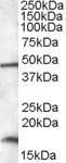 Anti-RBM3 antibody