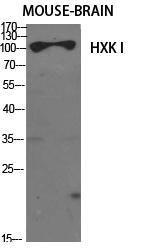 Western blot analysis of various cells using Anti-HXK1 Antibody