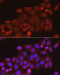 Immunofluorescence analysis of HeLa cells using Anti-TAZ Antibody (A306094) at a dilution of 1:50 (40x lens). DAPI was used to stain the cell nuclei (blue).