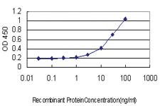 Anti-FBXL3 Mouse Monoclonal Antibody [clone: 3C4]