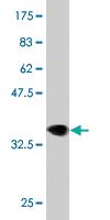 Anti-LRRK2 Mouse Monoclonal Antibody [clone: 3B2]