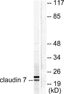 Western blot analysis of lysates from 293 cells using Anti-Claudin 7 Antibody. The right hand lane represents a negative control, where the Antibody is blocked by the immunising peptide