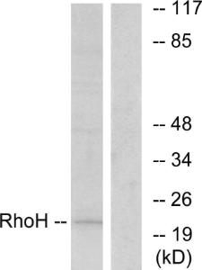 Anti-RHOH Rabbit Polyclonal Antibody